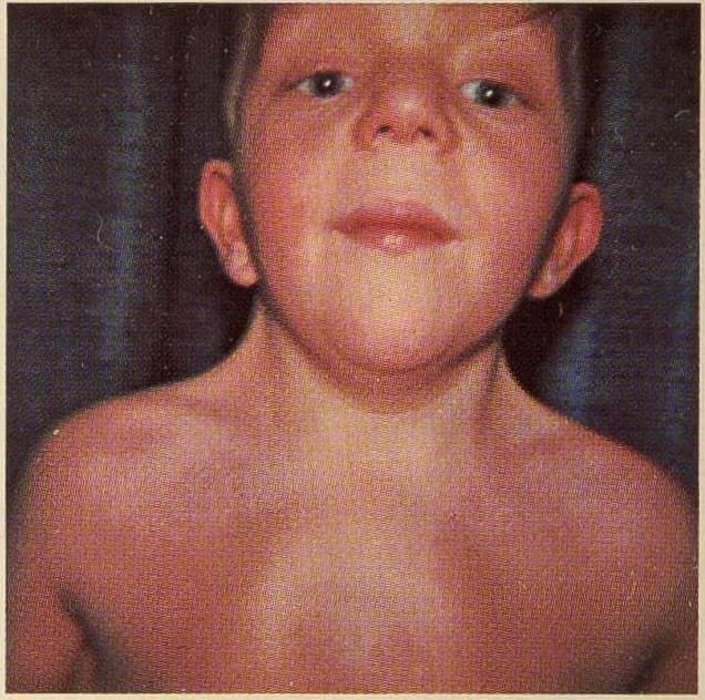 Suus (15) heeft CTNNB1-syndroom, diagnose duurde lang